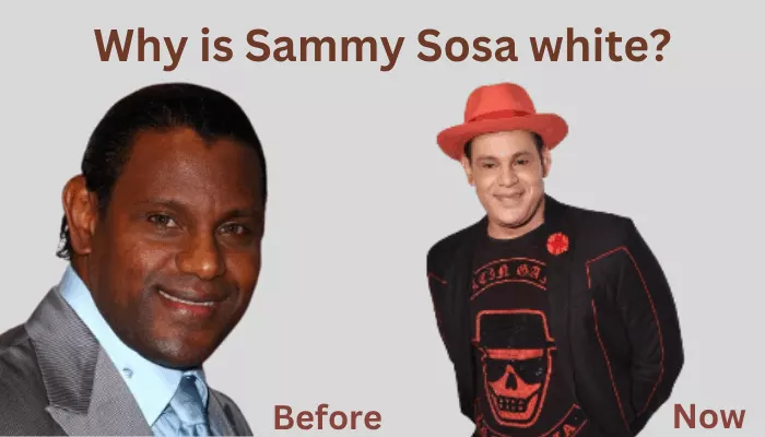 Why is Sammy Sosa white